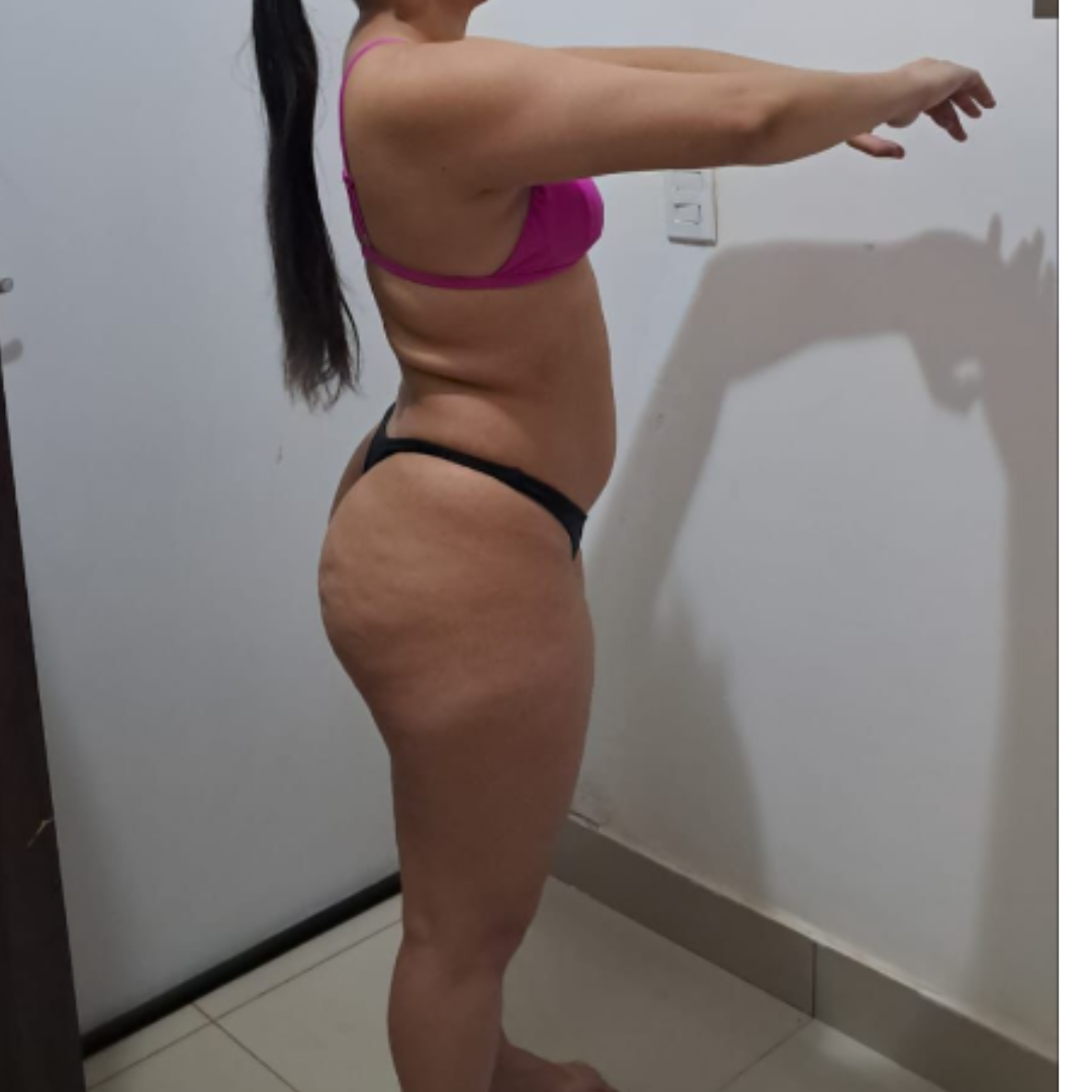 Antes